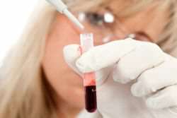 Как определить группу крови ребенка по группе крови родителей?
