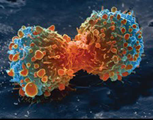 Раковая клетка
