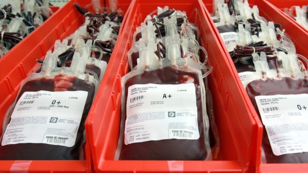 Бомбейский феномен: история открытия. Универсальный донор крови