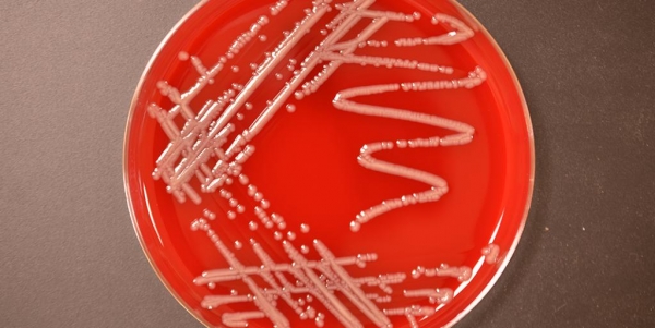 Enterobacter cloacae: расшифровка, норма и патология