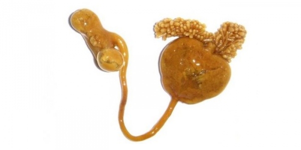Сфирион люмпи - опасен ли для человека и фото паразита морского окуня