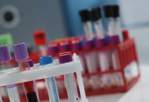 Бомбейський феномен: історія відкриття. Універсальний донор крові