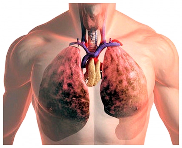 Что значит везикулярное дыхание?