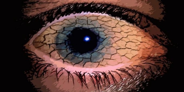 Синдром сухого глаза – болезнь современного общества