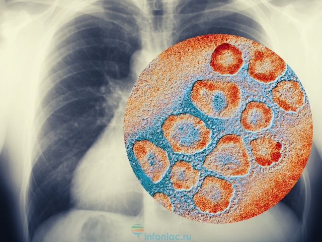 Новый коронавирус из Китая: все, что вы хотели о нем знать 