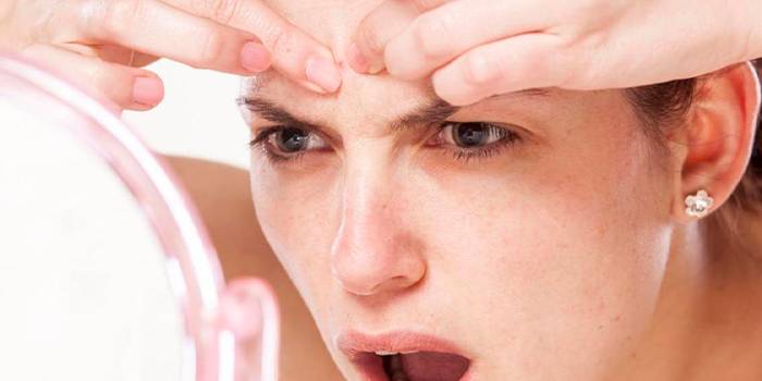 6 советов дерматолога, как можно и нельзя избавляться от прыщей