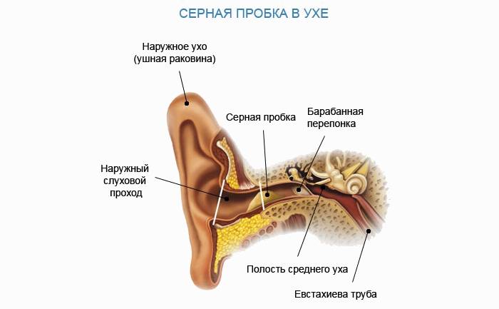 5 причин, почему вы можете слышать звон в ушах