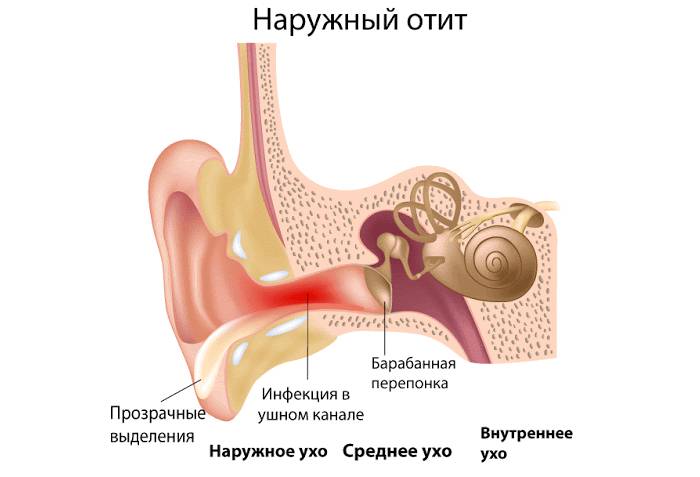 7 причин, когда зуд в ушах доставляет огромный дискомфорт