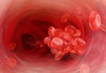 Експерти назвали продукти харчування, які можуть провокувати інсульт та тромбоз