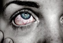 Червоні очі: як позбутися почервоніння за допомогою простих домашніх засобів