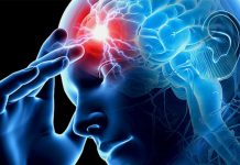 3 головні ознаки інсульту: діяти потрібно негайно