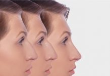 Форма носа розповість про твою особистость