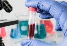 Терапія стовбуровими клітинами перспективна при дегенеративних захворюваннях очей