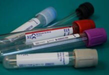 Біохімічний аналіз крові: що показує і як правильно інтерпретувати результати