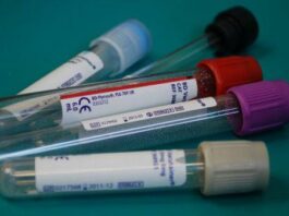 Біохімічний аналіз крові: що показує і як правильно інтерпретувати результати