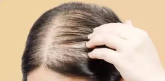 почему девушки страдают потерей волос