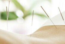 Вчені вивчили ефективність голковколювання для полегшення лікування раку