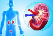 Мочекаменная болезнь: современные аспекты диагностики и лечения