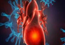 Вчені довели прямий вплив COVID-19 на коронарні артерії