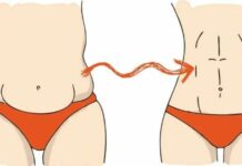 Чи є процедура видалення жиру і підтяжки живота методом схуднення