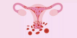 кровотеча під час місячних