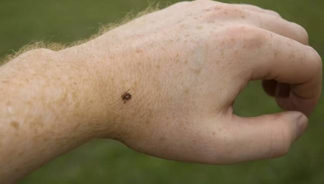 Почему после укуса клеща появляется аллергия на мясо