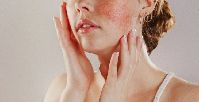 Почему важно определить свой тип кожи