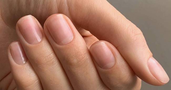 О каким проблемах здоровья могут сигнализировать ногти