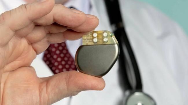 Когда необходимо поставить кардиостимулятор