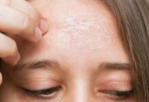 Поширені причини сильного свербежу