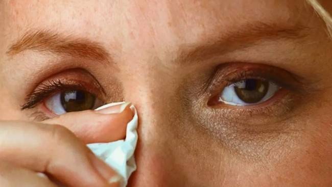 Слезятся глаза без видимой причины