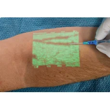 portable-venous-scanners-228x228 Венозний сканер